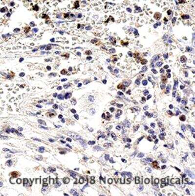Immunohistochemistry-Paraffin: Notch-1 Antibody (mN1A) - BSA Free [NB100-78486]