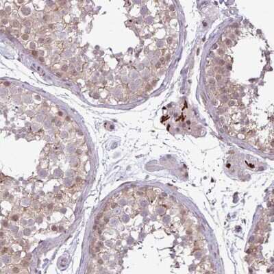 Immunohistochemistry-Paraffin: Notch-2 Antibody [NBP2-48913]