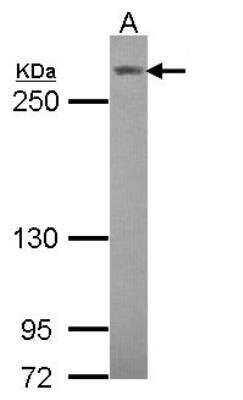 Western Blot: Notch-3 Antibody [NBP2-19567]