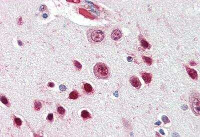 Immunohistochemistry-Paraffin: Nova1 Antibody [NBP1-00221]