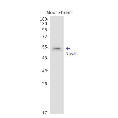 Western Blot: Nova1 Antibody (S06-8K6) [NBP3-19720]