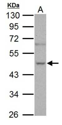 Western Blot: Nova1 Antibody [NBP1-32459]