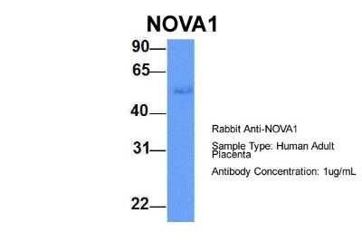 Western Blot: Nova1 Antibody [NBP1-57397]