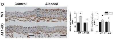 Immunohistochemistry: Nox4 Antibody - BSA Free [NB110-58849]