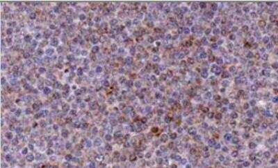 Immunohistochemistry-Paraffin: Noxa Antibody (114C307.1) - Azide Free [NBP2-33250]