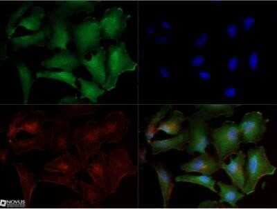 Immunocytochemistry/ Immunofluorescence: Noxa Antibody (114C307.1) - Non-Recombinant Monoclonal [NB600-1159]
