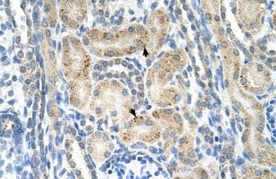 Immunohistochemistry-Paraffin: NrCAM Antibody [NBP1-59501]