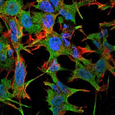 Immunocytochemistry/ Immunofluorescence: NrCAM Antibody (S364-51) [NBP2-42191]
