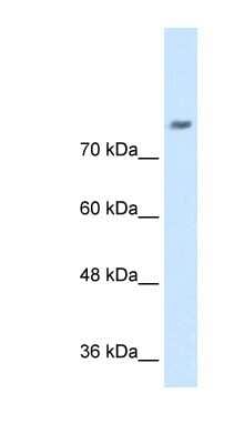 Western Blot: NrCAM Antibody [NBP1-59490]
