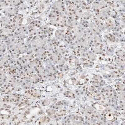 Immunohistochemistry-Paraffin: Nrf1 Antibody [NBP1-89125]