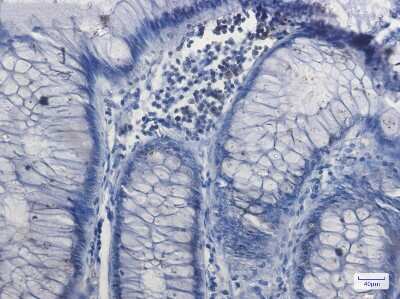 Immunohistochemistry-Paraffin: Nrf1 Antibody (S02-9A7) [NBP3-14960]