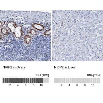 Immunohistochemistry-Paraffin: Nrip2 Antibody [NBP1-85033]