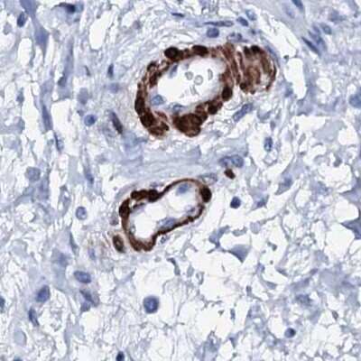 Immunohistochemistry-Paraffin: Nrip2 Antibody [NBP1-85033]
