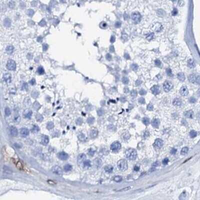 Immunohistochemistry-Paraffin: Nrip2 Antibody [NBP1-85033]