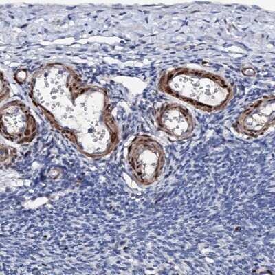 Immunohistochemistry-Paraffin: Nrip2 Antibody [NBP1-85034]