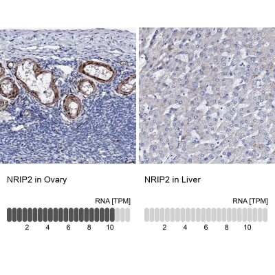 Immunohistochemistry-Paraffin: Nrip2 Antibody [NBP1-85034]