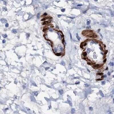 Immunohistochemistry-Paraffin: Nrip2 Antibody [NBP1-85034]