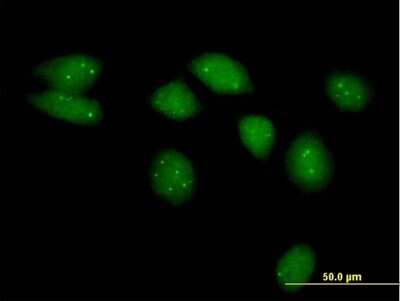 Immunocytochemistry/ Immunofluorescence: Nse2 Antibody [H00286053-B01P]