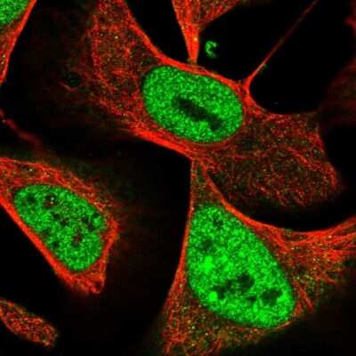 Immunocytochemistry/ Immunofluorescence: NuMA Antibody [NBP2-54672]