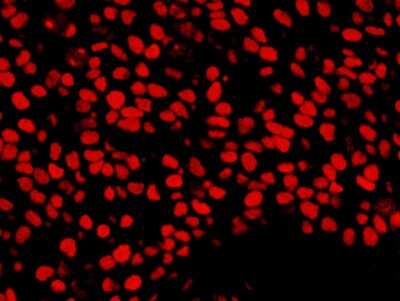 Immunohistochemistry: NuMA Antibody [NB100-74636]