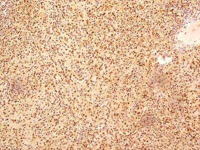 Immunohistochemistry-Paraffin: NuMA Antibody [NB500-174]