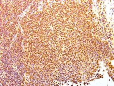 Immunohistochemistry-Frozen: Nuclear Antigen Antibody (235-1) [NBP2-34342]