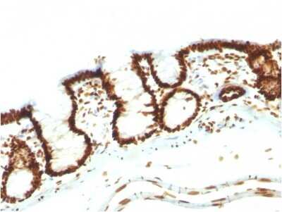 Immunohistochemistry-Paraffin: Nuclear Antigen Antibody (NM106) - IHC-Prediluted [NBP2-48213]
