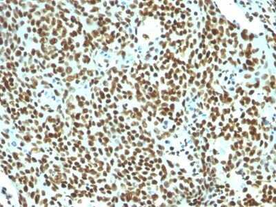 Immunohistochemistry-Paraffin: Nuclear Antigen Antibody (NM106) [NBP2-45273]