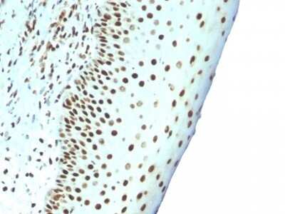 Immunohistochemistry-Paraffin: Nuclear Antigen Antibody (NM106) [NBP2-45273]