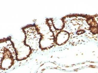 Immunohistochemistry-Paraffin: Nuclear Antigen Antibody (NM106) [NBP2-45273]