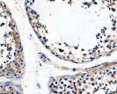 Immunohistochemistry-Paraffin: Nuclear Antigen Antibody (NM106) [NBP2-45273]