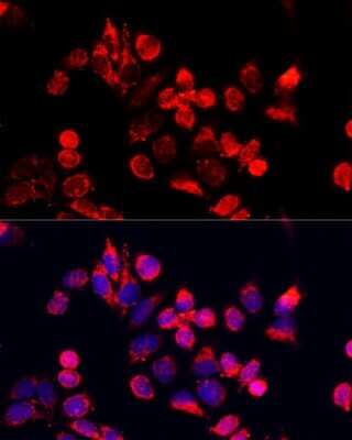 Immunocytochemistry/ Immunofluorescence: Nuclear Factor Erythroid 2 Related Factor 1 Antibody - Azide and BSA Free [NBP2-93792]