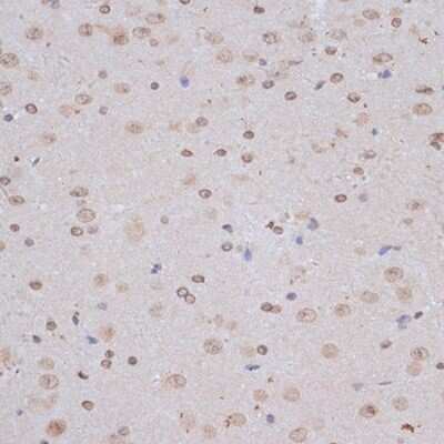 Immunohistochemistry-Paraffin: Nuclear Factor Erythroid 2 Related Factor 1 Antibody - Azide and BSA Free [NBP2-93792]