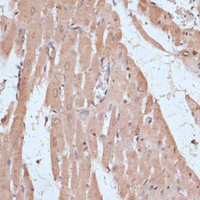 Immunohistochemistry-Paraffin: Nuclear Factor Erythroid 2 Related Factor 1 Antibody - Azide and BSA Free [NBP2-93792]