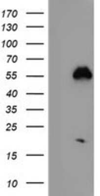 Western Blot: Nucleobindin 1 Antibody (OTI1A5) [NBP2-01446]