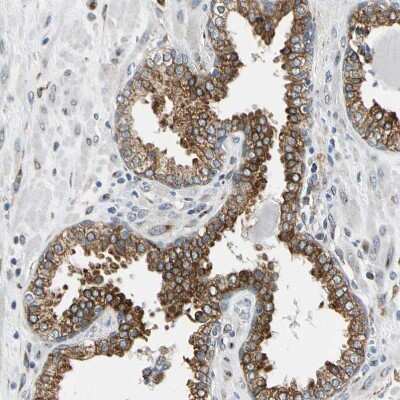 Immunohistochemistry-Paraffin: Nucleobindin 1 Antibody [NBP1-88217]