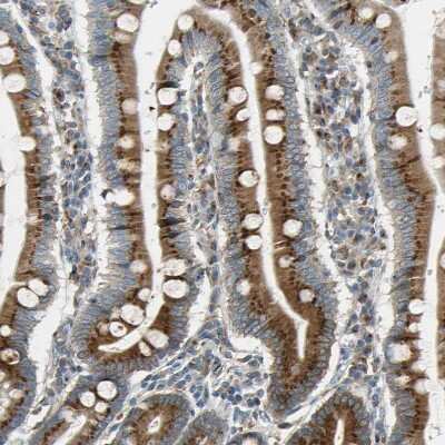Immunohistochemistry-Paraffin: Nucleobindin 1 Antibody [NBP1-88217]