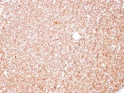 Immunohistochemistry-Paraffin: Nucleoli Marker Antibody (NM95) - Azide and BSA Free [NBP2-34695]