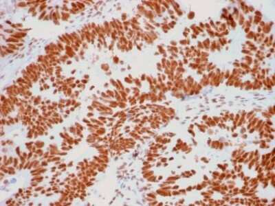 Immunohistochemistry-Paraffin: Nucleoli Marker Antibody (NM95) - IHC-Prediluted [NBP2-45215]