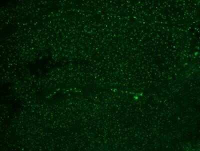 Immunohistochemistry-Paraffin: Nucleoli Marker Antibody (NM95) - IHC-Prediluted [NBP2-45215]