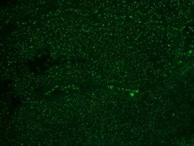 Immunohistochemistry-Paraffin: Nucleoli Marker Antibody (NM95) [NBP2-32886]