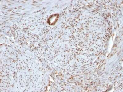 Immunohistochemistry-Paraffin: Nucleolin Antibody (364-5 + NCL/902) - Azide and BSA Free [NBP2-47862]