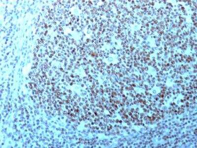 Immunohistochemistry-Paraffin: Nucleolin Antibody (364-5 + NCL/902) - IHC-Prediluted [NBP2-48320]
