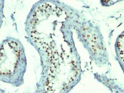 Immunohistochemistry-Paraffin: Nucleolin Antibody (364-5 + NCL/902) - IHC-Prediluted [NBP2-48320]