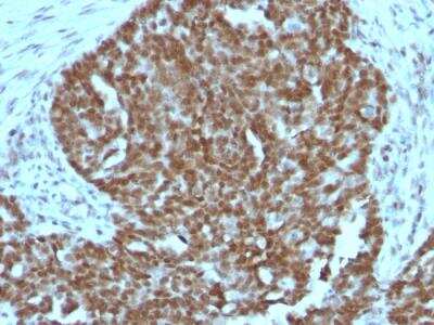 Immunohistochemistry-Paraffin: Nucleolin Antibody (364-5 + NCL/902) - IHC-Prediluted [NBP2-48320]