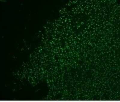 Immunohistochemistry-Paraffin: Nucleolin Antibody (364-5 + NCL/902) - IHC-Prediluted [NBP2-48320]