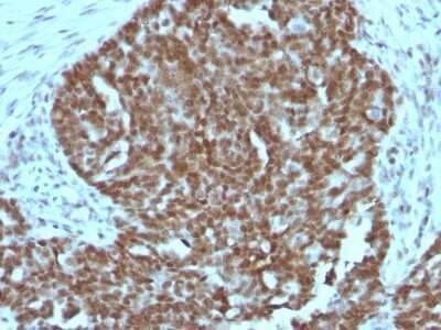 Immunohistochemistry-Paraffin: Nucleolin Antibody (364-5 + NCL/902) [NBP2-44613]
