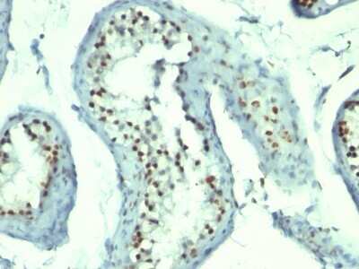 Immunohistochemistry-Paraffin: Nucleolin Antibody (364-5 + NCL/902) [NBP2-44613]