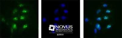 Immunocytochemistry/ Immunofluorescence: Nucleolin Antibody [NB100-1920]