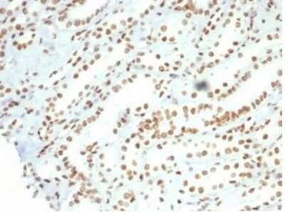 Immunohistochemistry-Paraffin: Nucleolin Antibody (NCL/7014R) - Azide and BSA Free [NBP3-11038]